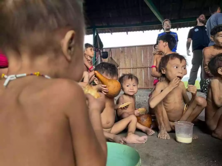 Niños yanomami con síntomas de desnutrición